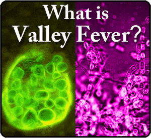 sbwhatisvf What is Valley Fever?