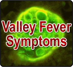 Valley Fever Symptoms Valley Fever Symptoms
