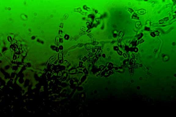 biotergreen Coccidioides sp. mycelia in a green gradient as a background on ValleyFeverSurvivor.com