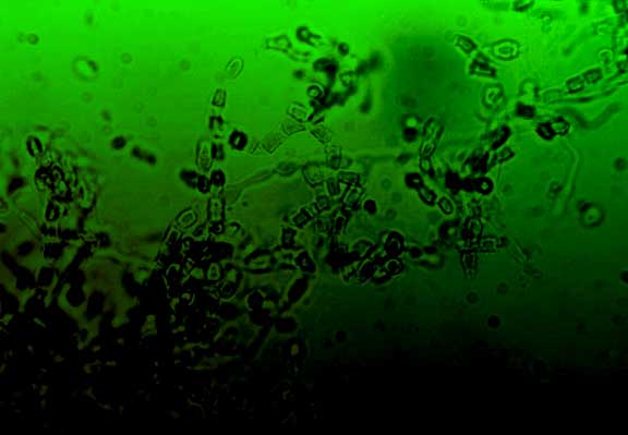 biotergreen Coccidioides sp. mycelia in a green gradient as a background on ValleyFeverSurvivor.com