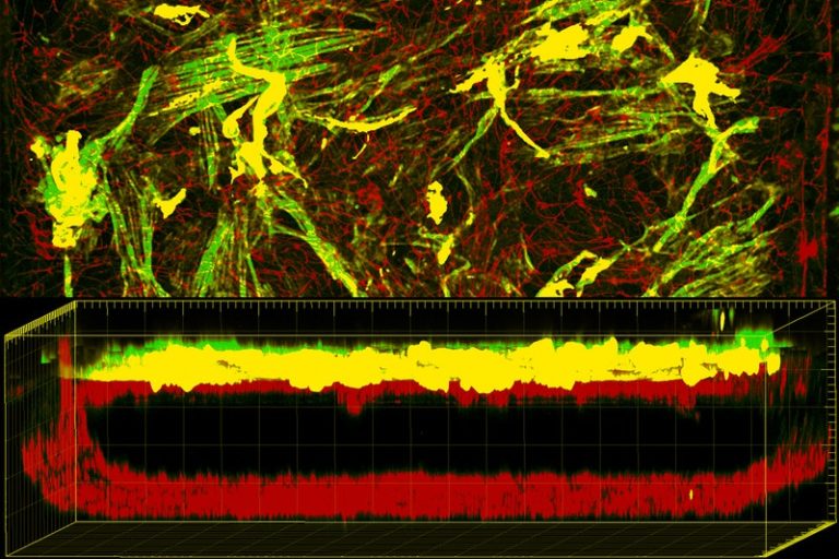 Donald Ingber, M.D.,Ph.D. at Harvard’s Wyss Institute for Biologically Inspired Engineering is creating a Blood Brain Barrier on a Chip