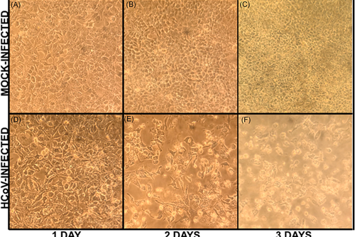 Mouthwash vs COVID19 - if only something like this were ready for Valley Fever