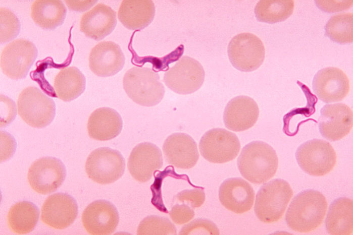 Trypanosoma is shown as an example of what people expect parasites to look like. Nonetheless, Valley Fever is also a parasitic disease.