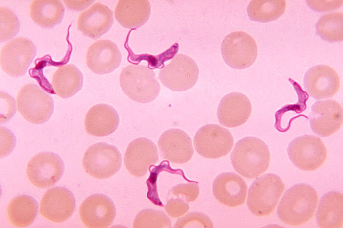 Trypanosoma is shown as an example of what people expect parasites to look like. Nonetheless, Valley Fever is also a parasitic disease.