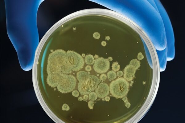 Valley Fever and other fungal deaths on the rise across America